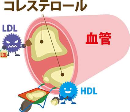 埼玉県の越谷にある水素サロンセルくれんず|コレステロールも中性脂肪も悪者じゃない